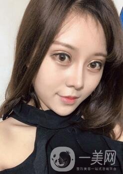 蘭大二院整形外科價格表2020，附雙眼皮整形日記