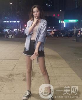 重慶西南醫(yī)院整形外科價(jià)格表2020新版出爐，附大腿吸脂案例