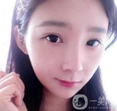 浙一醫(yī)院*誰(shuí)打的好?附真人案例及整形價(jià)格表