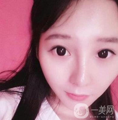 浙一醫(yī)院*誰(shuí)打的好?附真人案例及整形價(jià)格表