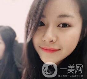 上海華美醫(yī)療美容醫(yī)院價格表，附雙眼皮修復(fù)案例