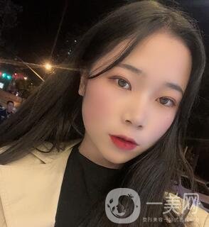 西安高一生醫(yī)療美容醫(yī)院價格表，附面部吸脂案例分享