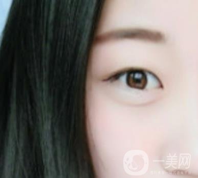 沈陽(yáng)百嘉麗醫(yī)院價(jià)格表2020，附雙眼皮案例分享