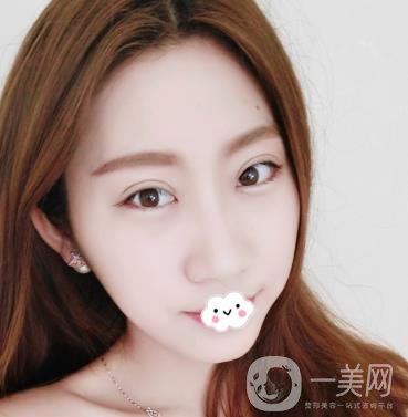 沈陽(yáng)百嘉麗醫(yī)院價(jià)格表2020，附雙眼皮案例分享