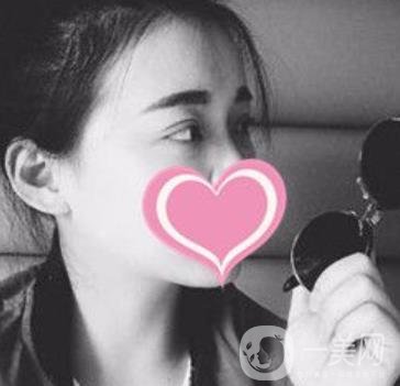 濟南中心醫(yī)院價格表，雙眼皮整形日記公布