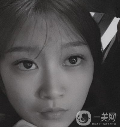 青島新陽(yáng)光婦產(chǎn)醫(yī)院縮陰手術(shù)恢復(fù)經(jīng)歷和價(jià)格價(jià)目表一覽