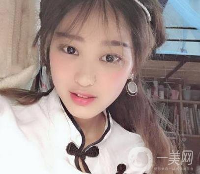 西安華旗唯美整形醫(yī)院做*多少錢？價格表收費(fèi)明細(xì)和案例分享