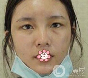 襄陽中心醫(yī)院整形美容科價(jià)格表2020版出爐，附雙眼皮日記