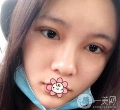 襄陽中心醫(yī)院整形美容科價(jià)格表2020版出爐，附雙眼皮日記