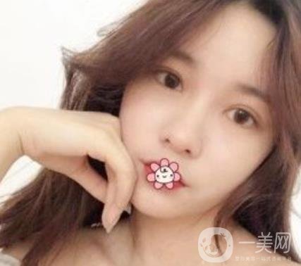 襄陽中心醫(yī)院整形美容科價(jià)格表2020版出爐，附雙眼皮日記