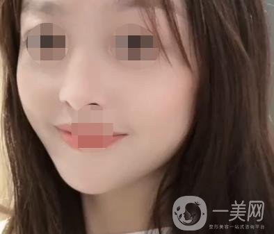 岳陽市一人民醫(yī)院整形美容科價格表及祛斑案例發(fā)布