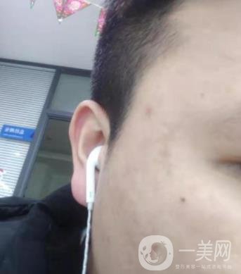 廣州名韓整形醫(yī)院價(jià)格表費(fèi)用詳情+激光祛斑案例分享