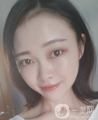 徐州亞韓整形醫(yī)院價格表費用明細，附面部除皺日記展示