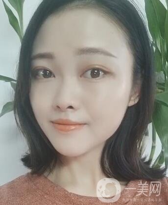 徐州亞韓整形醫(yī)院價格表費用明細，附面部除皺日記展示