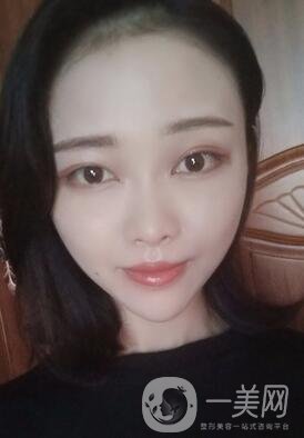 徐州亞韓整形醫(yī)院價格表費用明細，附面部除皺日記展示