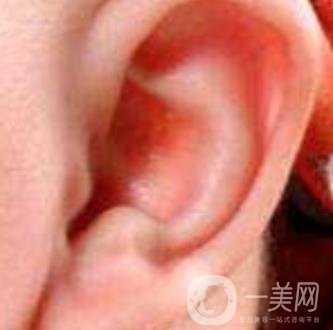 中國(guó)醫(yī)學(xué)科學(xué)院整形外科醫(yī)院外耳再造技術(shù)如何?*果好嗎?價(jià)格表收費(fèi)標(biāo)準(zhǔn)一覽