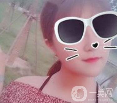 北京亞楠容悅醫(yī)療美容**果靠譜嗎?2020年價(jià)格明細(xì)一覽表