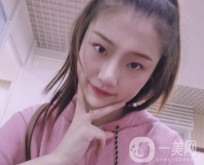 北京知音醫(yī)療美容熱瑪吉*果怎么樣？貴嗎？收費價格表2020公布