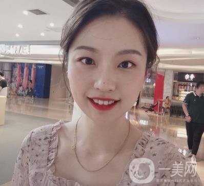 北京知音醫(yī)療美容熱瑪吉*果怎么樣？貴嗎？收費價格表2020公布