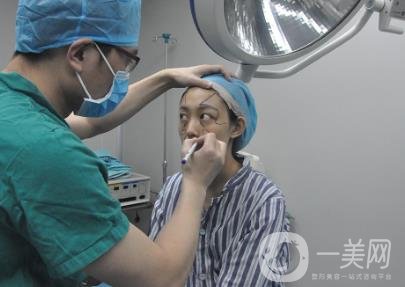 成都美容整形醫(yī)院做脂肪填充全臉*果靠譜嗎?近期價格表和案例參考