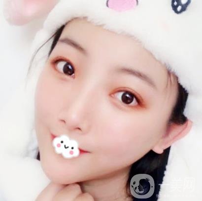 無錫二院雙眼皮做得好的醫(yī)生?附2020整形價格表及案例