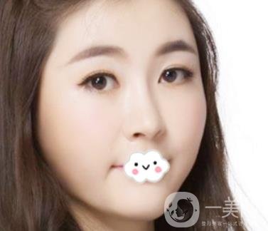 南昌二附院整形科新版價格表發(fā)布,附隆鼻案例前后