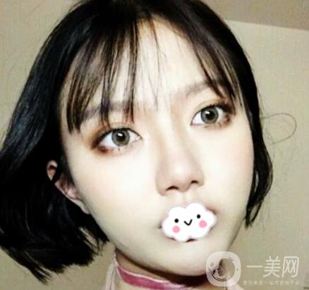 贛南醫(yī)學院第一附屬醫(yī)院整形美容科價格表2020+雙眼皮案例一覽