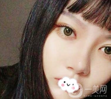 贛南醫(yī)學院第一附屬醫(yī)院整形美容科價格表2020+雙眼皮案例一覽