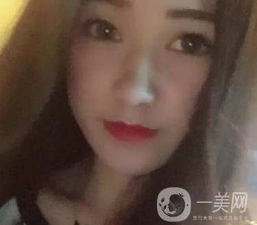 徐州第一人民醫(yī)院整形科價(jià)格表，含激光祛疤*果