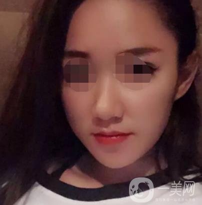 徐州第一人民醫(yī)院整形科價(jià)格表，含激光祛疤*果