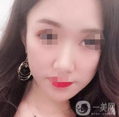 徐州第一人民醫(yī)院整形科價(jià)格表，含激光祛疤*果