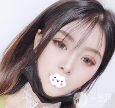 徐州亞韓整形醫(yī)院價(jià)格表2020新版+雙眼皮整形日記一覽