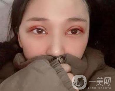 恩施州中心醫(yī)院美容整形科怎么樣？價(jià)格表和雙眼皮整形經(jīng)歷分享