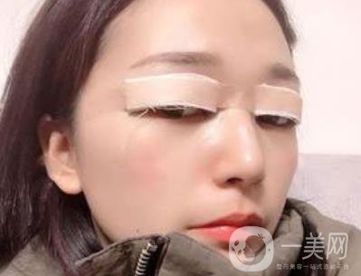 恩施州中心醫(yī)院美容整形科怎么樣？價(jià)格表和雙眼皮整形經(jīng)歷分享