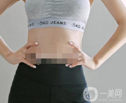 汾陽(yáng)醫(yī)院美容整形科祛妊娠紋怎么樣？手術(shù)項(xiàng)目收費(fèi)價(jià)格表和案例一覽