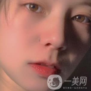 黃岡市中心醫(yī)院美容整形科祛痣多少錢？價格費(fèi)用表和*果圖精選