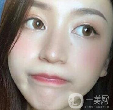 荊州市第三人民醫(yī)院整形美容科*祛斑*果好嗎？收費(fèi)價(jià)格明細(xì)表一覽