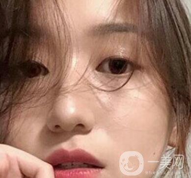 荊州市第三人民醫(yī)院整形美容科*祛斑*果好嗎？收費(fèi)價(jià)格明細(xì)表一覽