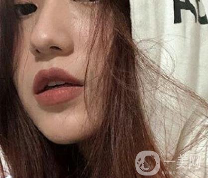 荊州市第三人民醫(yī)院整形美容科*祛斑*果好嗎？收費(fèi)價(jià)格明細(xì)表一覽