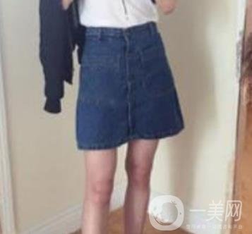 武漢市武昌醫(yī)院整形美容科價格表和吸脂瘦大腿案例精選圖公布