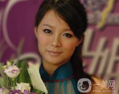 河北省人民醫(yī)院激光祛斑多少錢?附2020整形價(jià)格表一覽