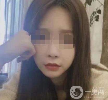 河北省人民醫(yī)院激光祛斑多少錢?附2020整形價(jià)格表一覽