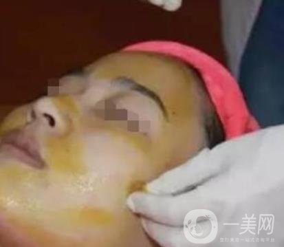 湖南省人民醫(yī)院點陣激光祛斑價格表及案例分享