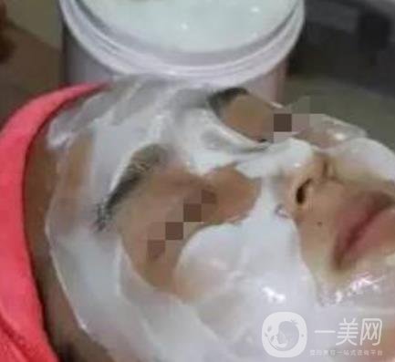 湖南省人民醫(yī)院點陣激光祛斑價格表及案例分享