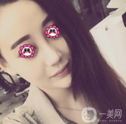 鼓樓醫(yī)院可以打*嗎?附案例恢復(fù)圖及整形價(jià)格表