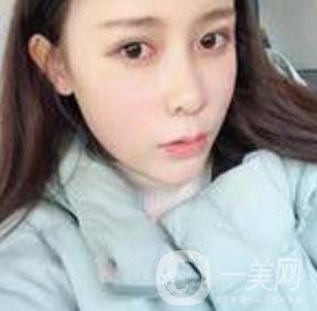 蘇州附一醫(yī)院可以激光祛斑嗎?案例圖及整形價(jià)格表分享