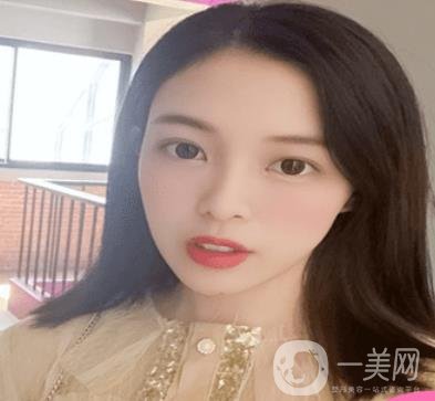 贛州附屬醫(yī)院整形美容科價格表及點(diǎn)痣案例公布，速覽