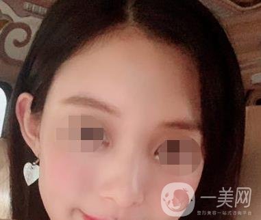 贛州附屬醫(yī)院整形美容科價格表及點(diǎn)痣案例公布，速覽