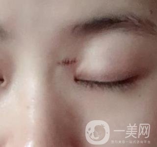 贛州附屬醫(yī)院整形美容科價格表及點(diǎn)痣案例公布，速覽