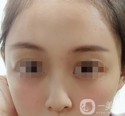 贛州附屬醫(yī)院整形美容科價格表及點(diǎn)痣案例公布，速覽